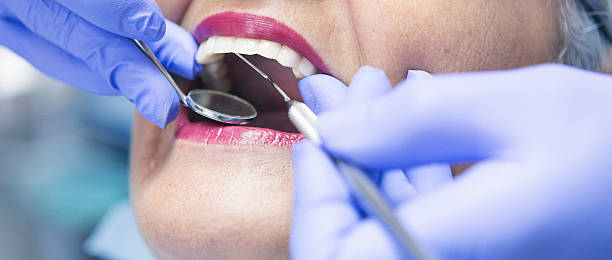 Best Urgent Care for Lost Fillings or Crowns in Crystal Springs, MS