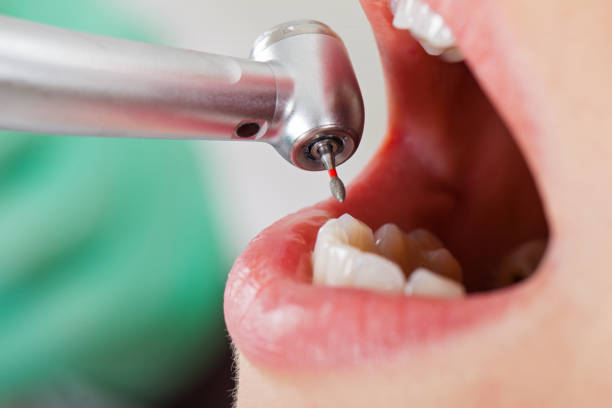 Best Same-Day Emergency Dental Services in Crystal Springs, MS
